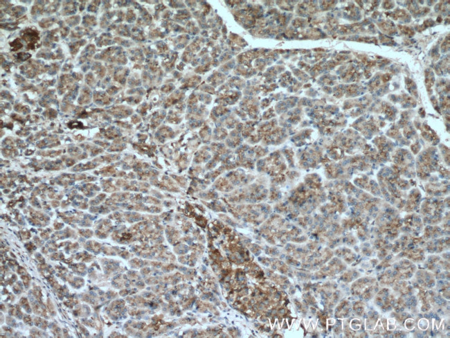 GAA Antibody in Immunohistochemistry (Paraffin) (IHC (P))