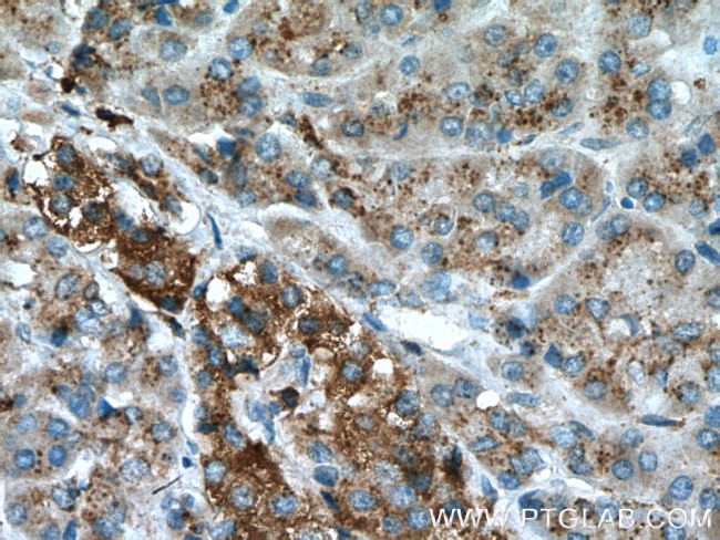 GAA Antibody in Immunohistochemistry (Paraffin) (IHC (P))