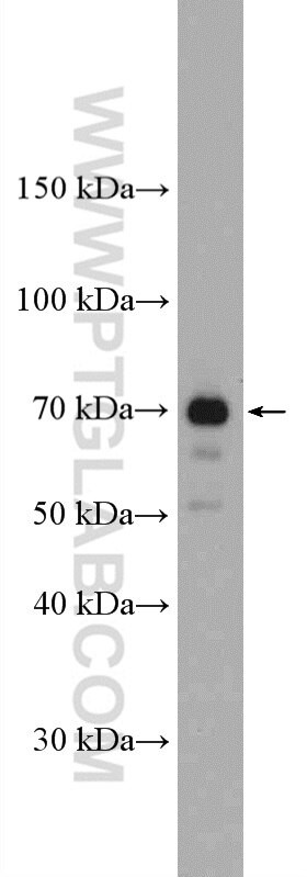 GAA Antibody in Western Blot (WB)