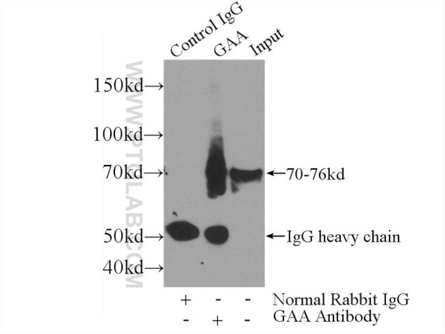 GAA Antibody in Immunoprecipitation (IP)