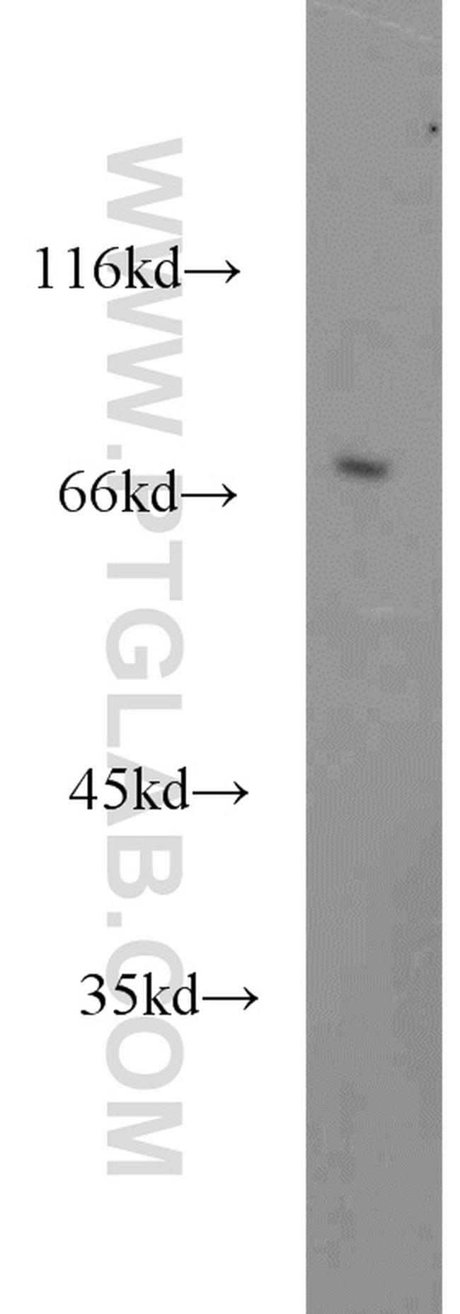 GAA Antibody in Western Blot (WB)