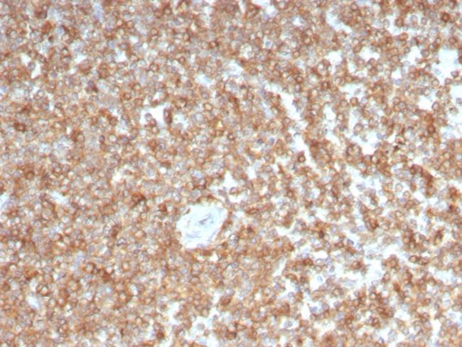 GM-CSF (Granulocyte/Macrophage - Colony Stimulating Factor) Antibody in Immunohistochemistry (Paraffin) (IHC (P))