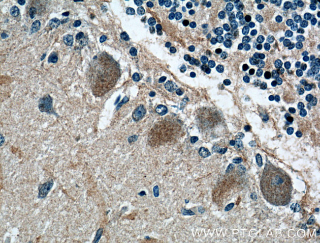 MTMR2 Antibody in Immunohistochemistry (Paraffin) (IHC (P))