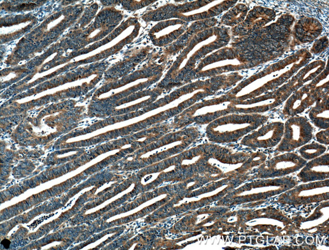 MTMR2 Antibody in Immunohistochemistry (Paraffin) (IHC (P))