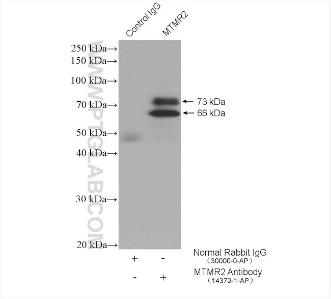 MTMR2 Antibody in Immunoprecipitation (IP)