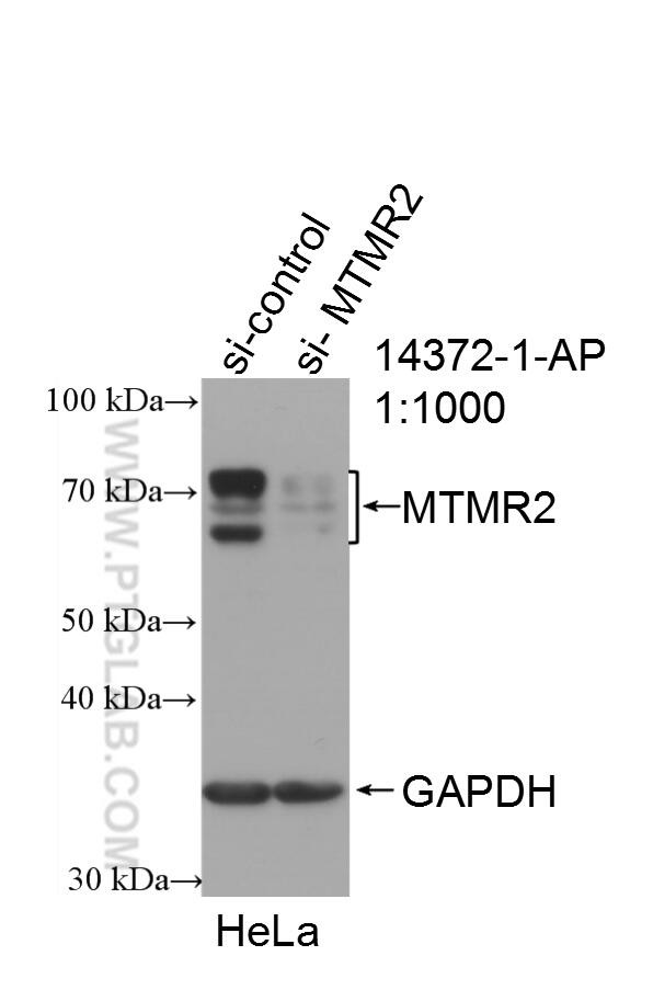 MTMR2 Antibody in Western Blot (WB)