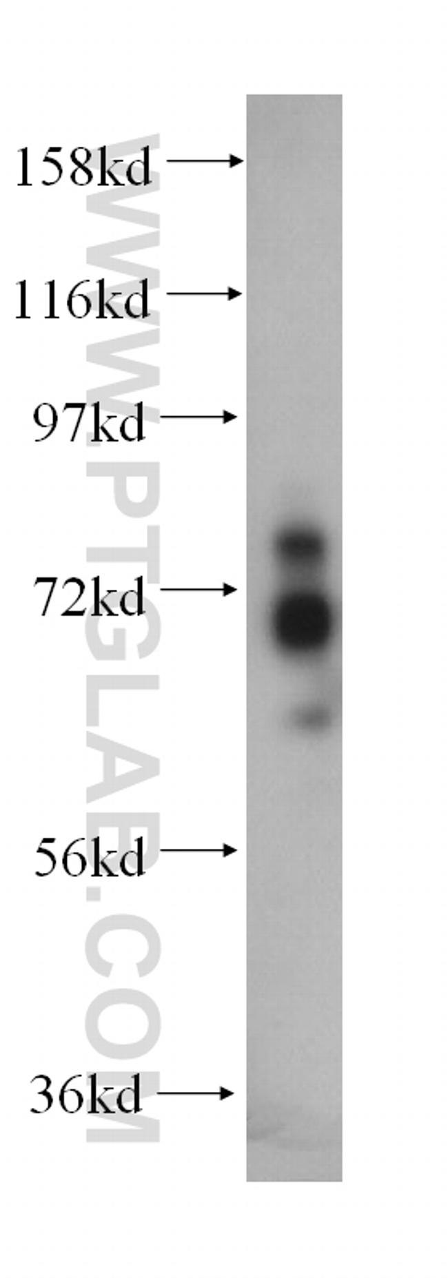 MTMR2 Antibody in Western Blot (WB)