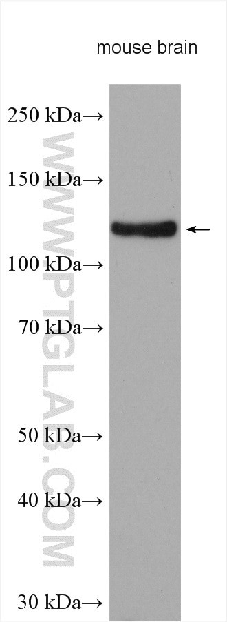 BMPR2 Antibody in Western Blot (WB)