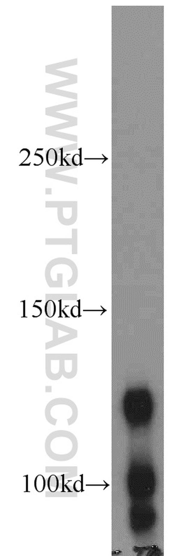 BMPR2 Antibody in Western Blot (WB)