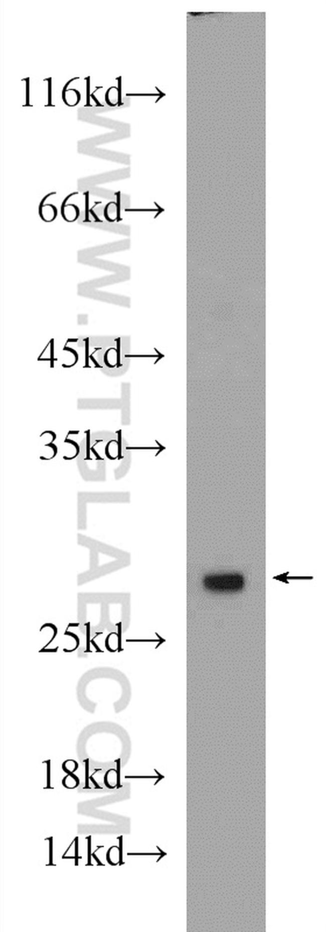 PSMA2 Antibody in Western Blot (WB)