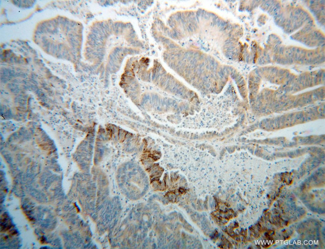 PON2 Antibody in Immunohistochemistry (Paraffin) (IHC (P))