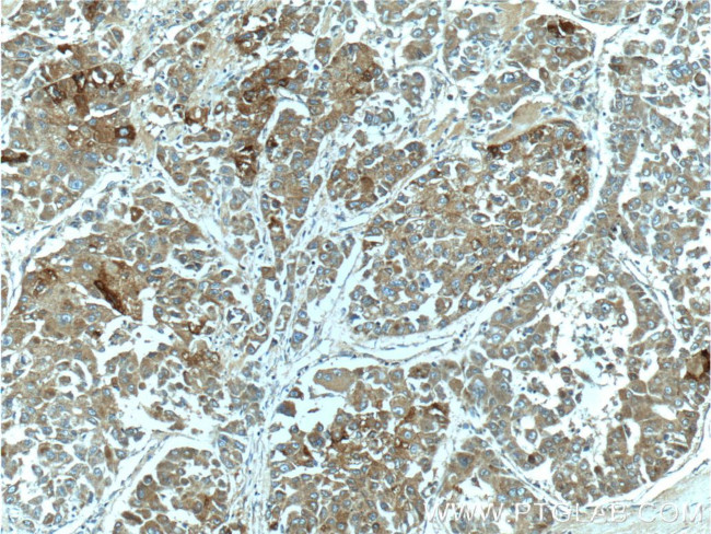 PON2 Antibody in Immunohistochemistry (Paraffin) (IHC (P))