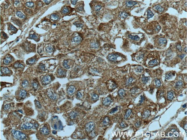 PON2 Antibody in Immunohistochemistry (Paraffin) (IHC (P))