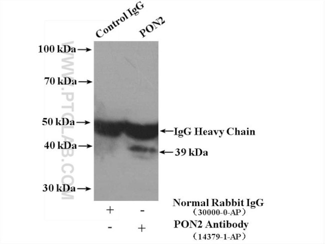 PON2 Antibody in Immunoprecipitation (IP)