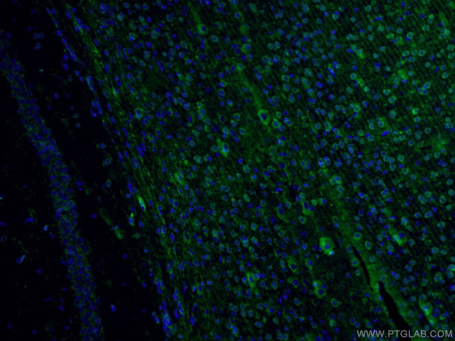 Fascin Antibody in Immunohistochemistry (PFA fixed) (IHC (PFA))