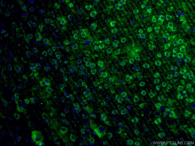 Fascin Antibody in Immunohistochemistry (PFA fixed) (IHC (PFA))