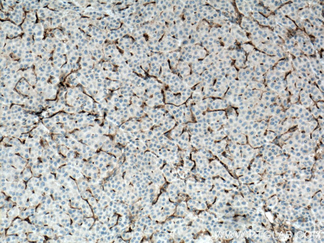 Fascin Antibody in Immunohistochemistry (Paraffin) (IHC (P))