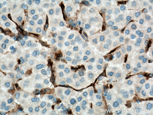 Fascin Antibody in Immunohistochemistry (Paraffin) (IHC (P))