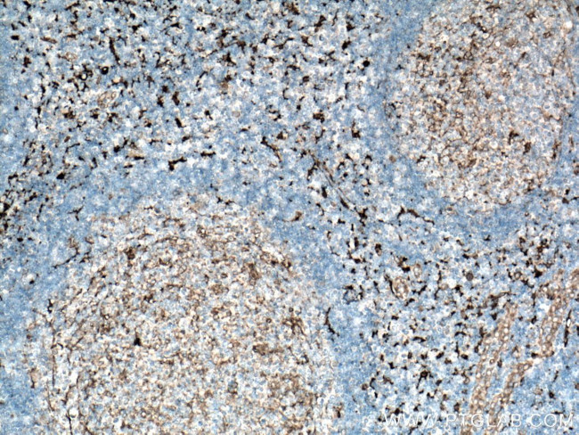 Fascin Antibody in Immunohistochemistry (Paraffin) (IHC (P))