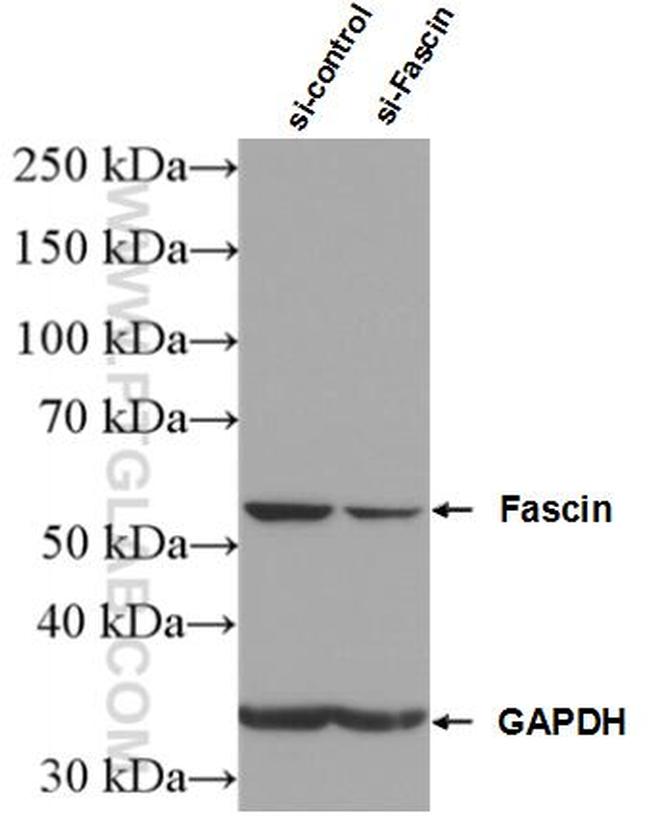 Fascin Antibody in Western Blot (WB)