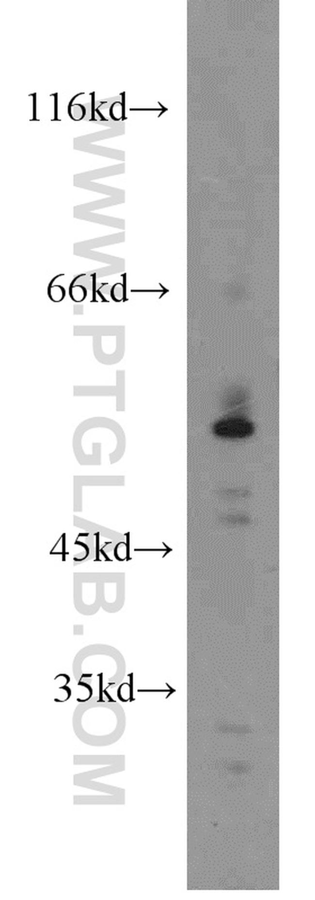 Fascin Antibody in Western Blot (WB)