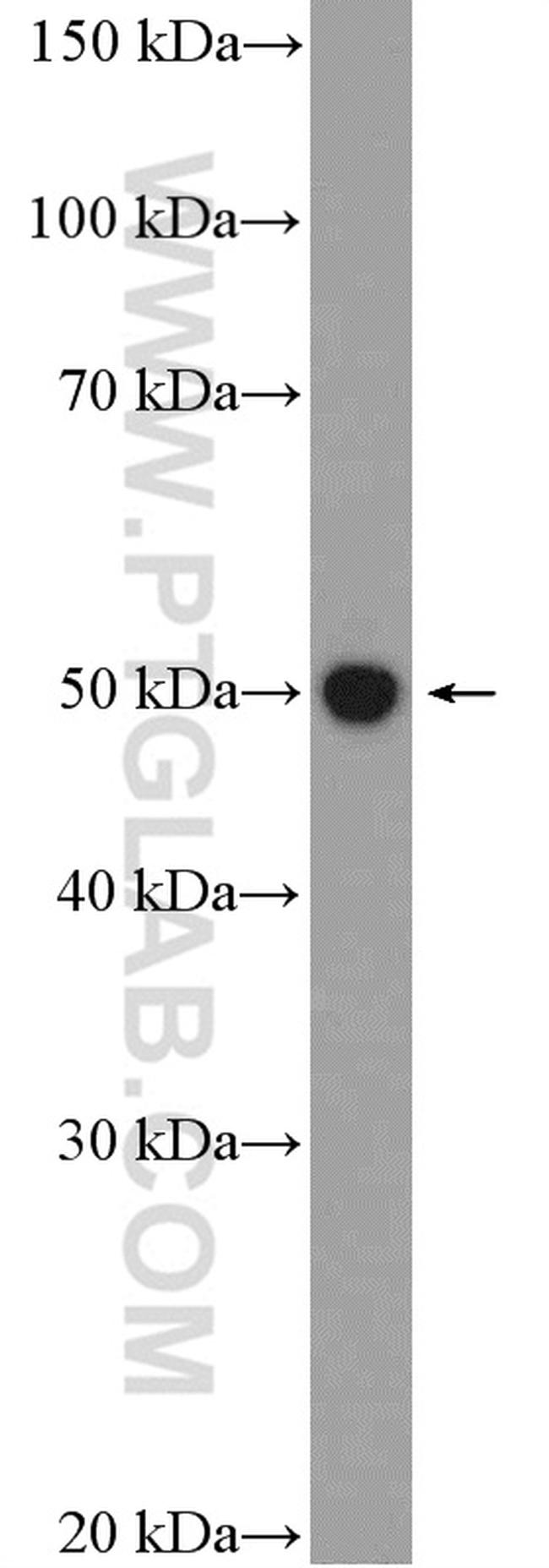 Fascin Antibody in Western Blot (WB)