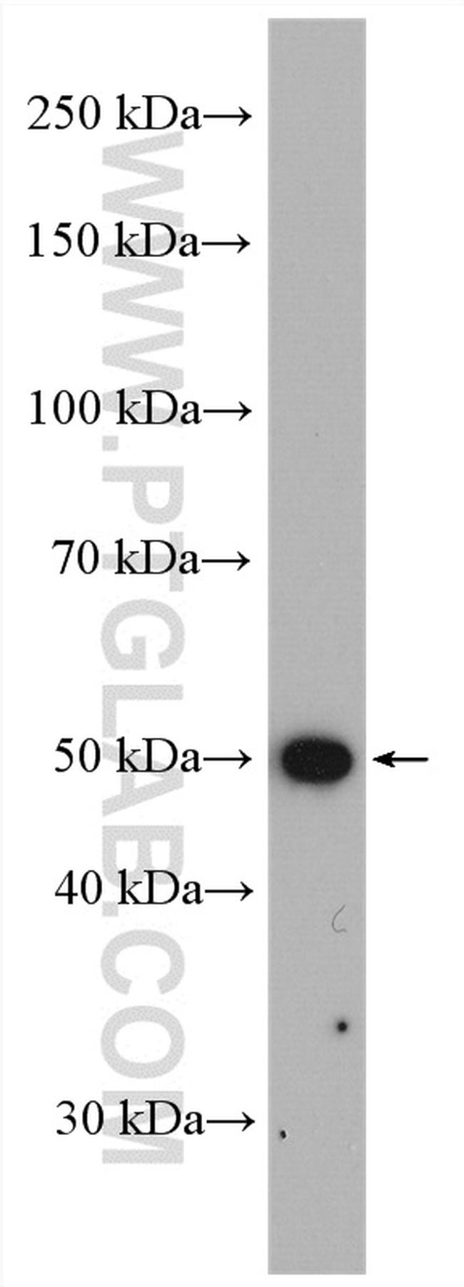 Fascin Antibody in Western Blot (WB)