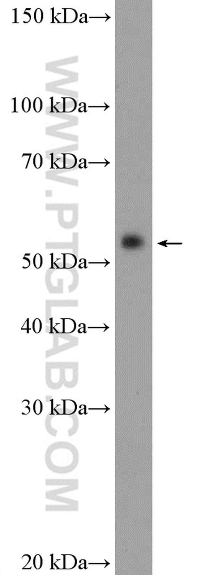 Fascin Antibody in Western Blot (WB)