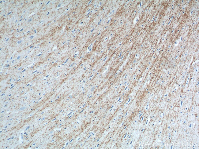 MAG Antibody in Immunohistochemistry (Paraffin) (IHC (P))