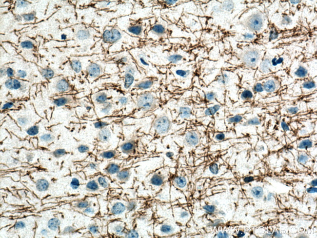 MAG Antibody in Immunohistochemistry (Paraffin) (IHC (P))