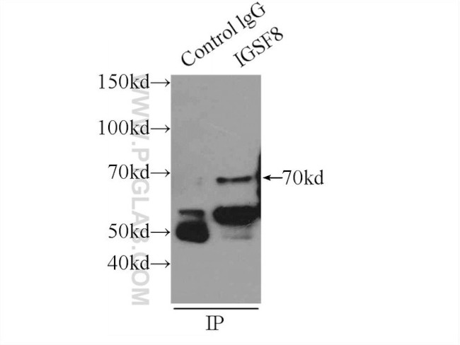 IGSF8 Antibody in Immunoprecipitation (IP)