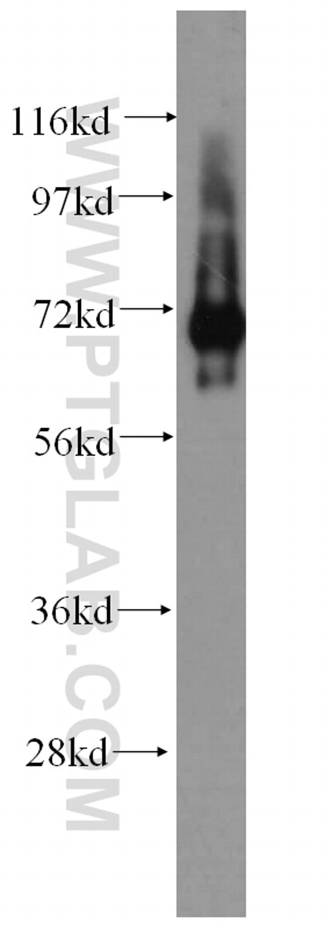 IGSF8 Antibody in Western Blot (WB)