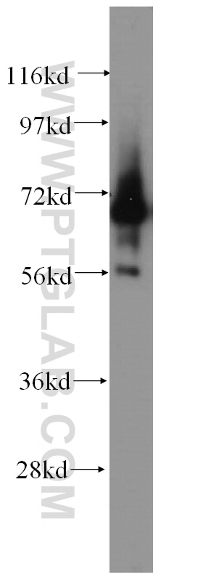 IGSF8 Antibody in Western Blot (WB)