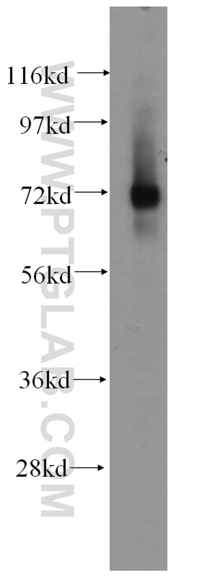 IGSF8 Antibody in Western Blot (WB)
