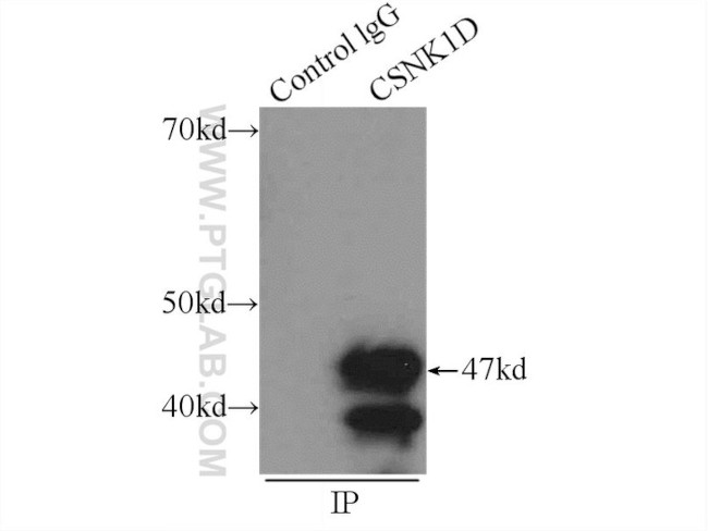 Casein Kinase 1 delta Antibody in Immunoprecipitation (IP)