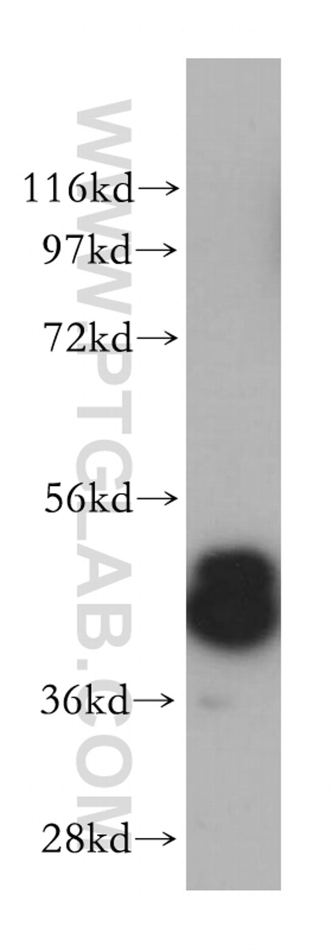 Casein Kinase 1 delta Antibody in Western Blot (WB)