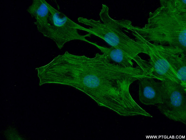 ACTA2/smooth muscle actin Antibody in Immunocytochemistry (ICC/IF)