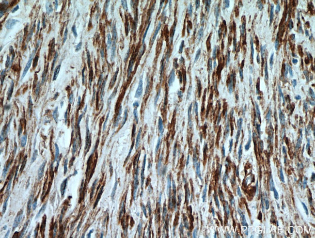 ACTA2/smooth muscle actin Antibody in Immunohistochemistry (Paraffin) (IHC (P))