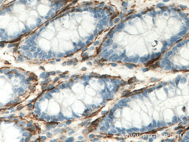 ACTA2/smooth muscle actin Antibody in Immunohistochemistry (Paraffin) (IHC (P))