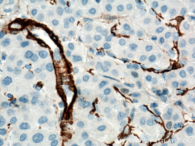 ACTA2/smooth muscle actin Antibody in Immunohistochemistry (Paraffin) (IHC (P))