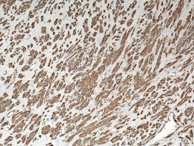 ACTA2/smooth muscle actin Antibody in Immunohistochemistry (Paraffin) (IHC (P))