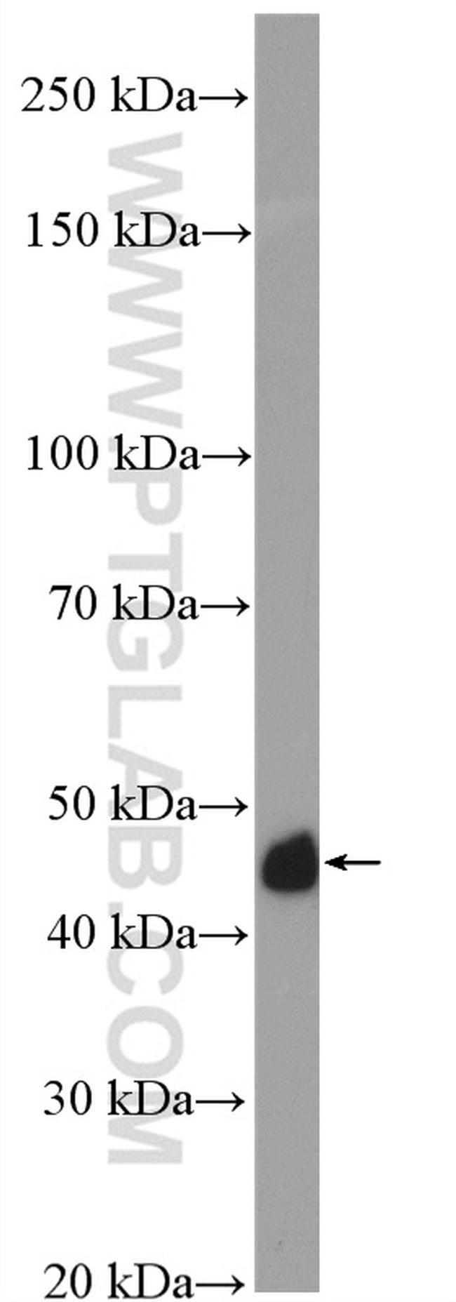 ACTA2/smooth muscle actin Antibody in Western Blot (WB)