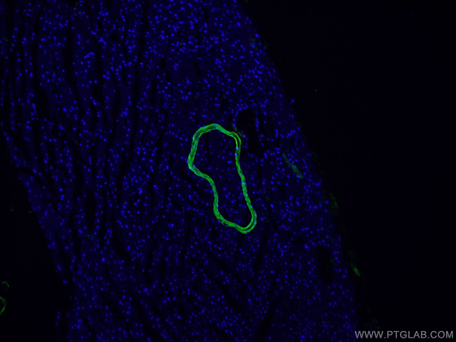 ACTA2/smooth muscle actin Antibody in Immunohistochemistry (PFA fixed) (IHC (PFA))