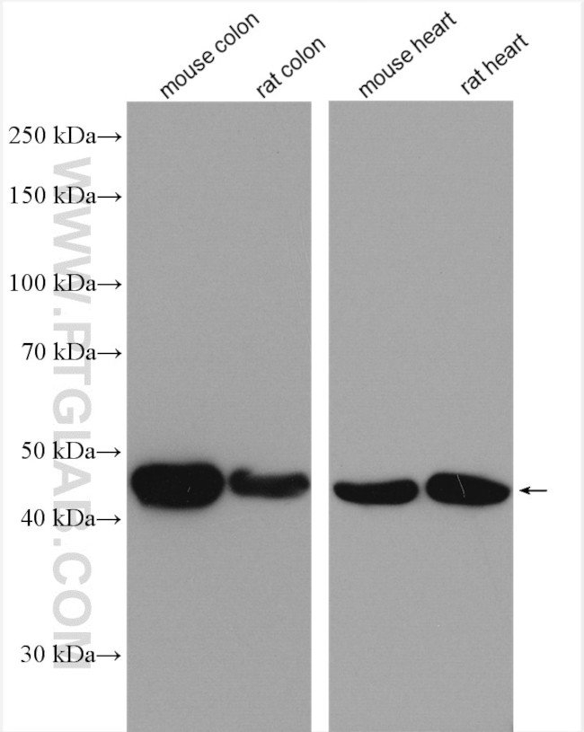 ACTA2/smooth muscle actin Antibody in Western Blot (WB)