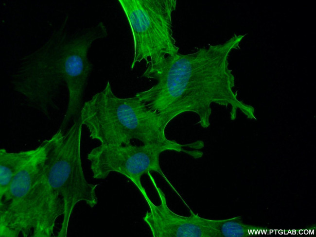 ACTA2/smooth muscle actin Antibody in Immunocytochemistry (ICC/IF)