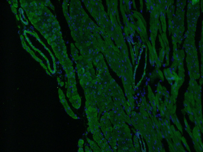 ACTA2/smooth muscle actin Antibody in Immunohistochemistry (PFA fixed) (IHC (PFA))