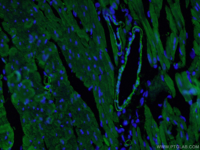 ACTA2/smooth muscle actin Antibody in Immunohistochemistry (PFA fixed) (IHC (PFA))