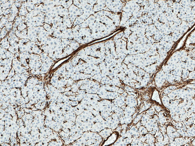 ACTA2/smooth muscle actin Antibody in Immunohistochemistry (Paraffin) (IHC (P))