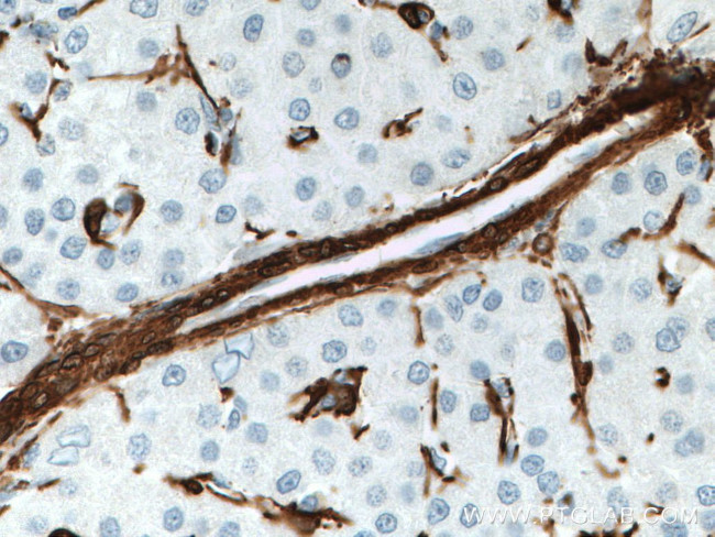 ACTA2/smooth muscle actin Antibody in Immunohistochemistry (Paraffin) (IHC (P))