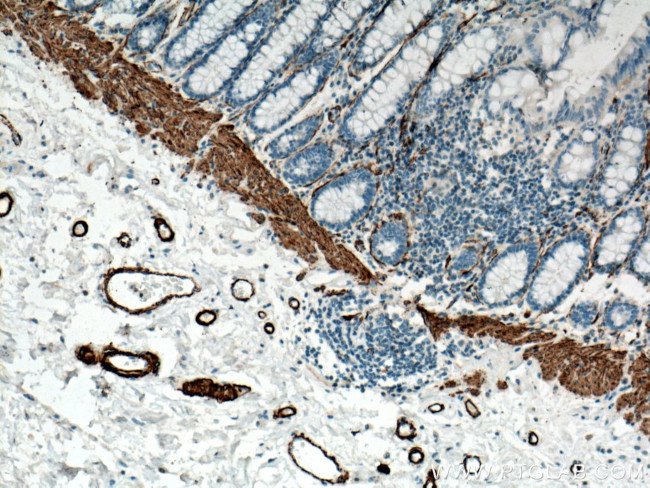 ACTA2/smooth muscle actin Antibody in Immunohistochemistry (Paraffin) (IHC (P))